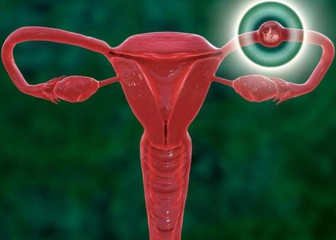 输卵管堵塞为何会导致不孕？是什么原因造成的？你了解过吗？